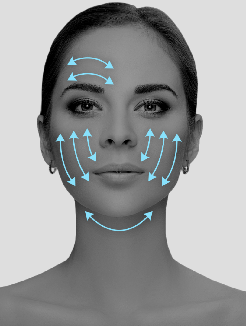 Круговая подтяжка лица и шеи 